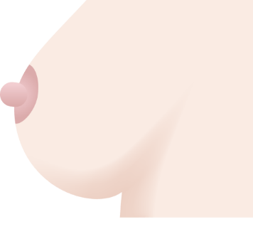 乳頭縮小