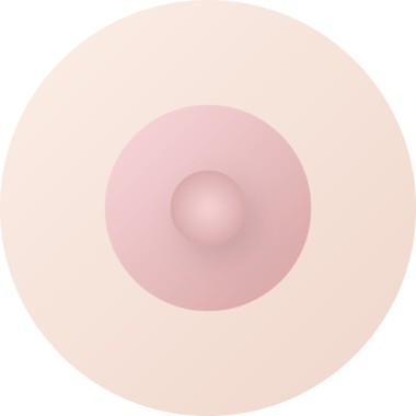 モントゴメリー線除去