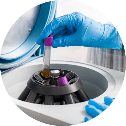 脂肪の加工処理