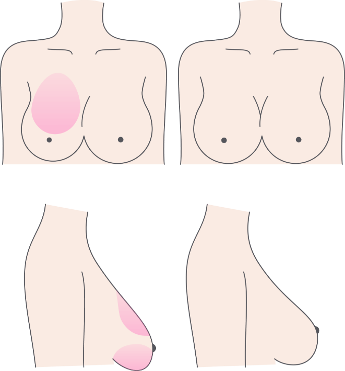 デコルテから谷間をふっくらと寄せやすく