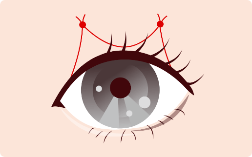 点留めのイラスト