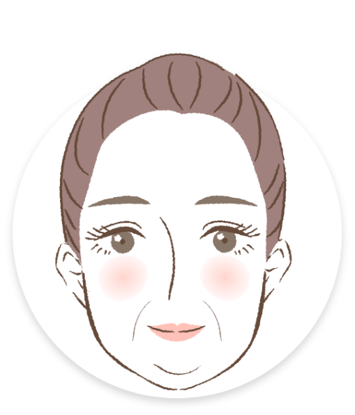 ほほの下垂ほうれい線